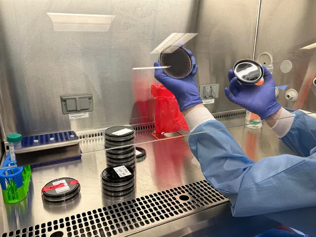 Legionella culture plates in a laboratory